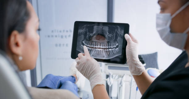Licensed Root Canal Treatment service in North Wales, PA - Smile Center Dentistry